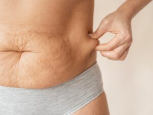 collagen boosting foods